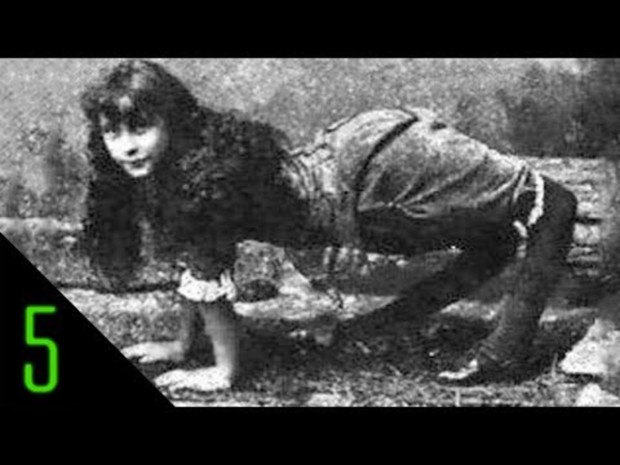 5 Most Incredible Sideshow Freaks Part 1
